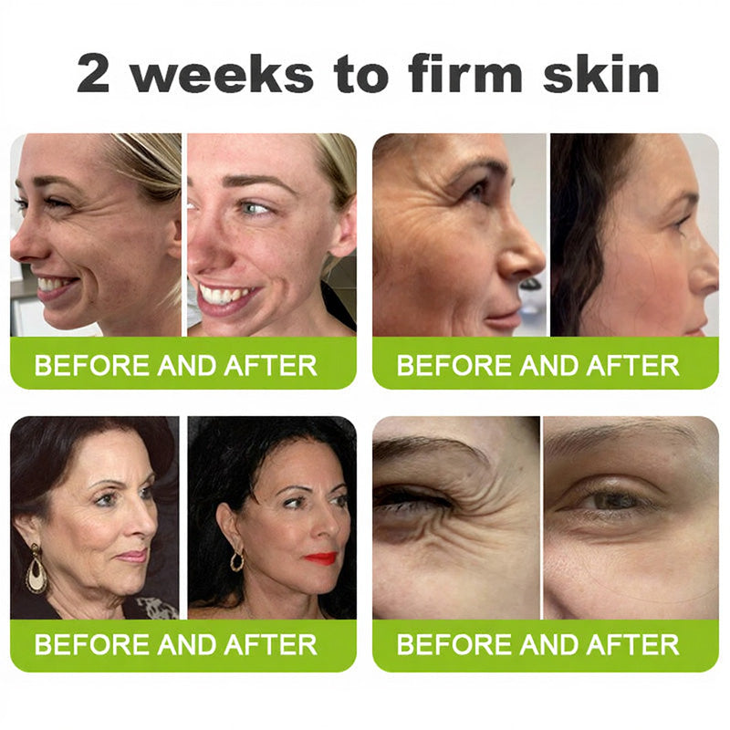 Skin Tightening & Vita-A Retinol Shot