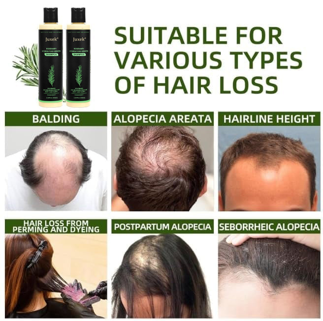 🔥LAST DAY 50% OFF - 🎅Juxek® Organic Rosemary Hair Growth Shampoo